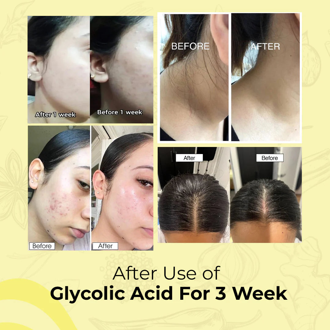 Glycolic Acid 7% Toning Solution